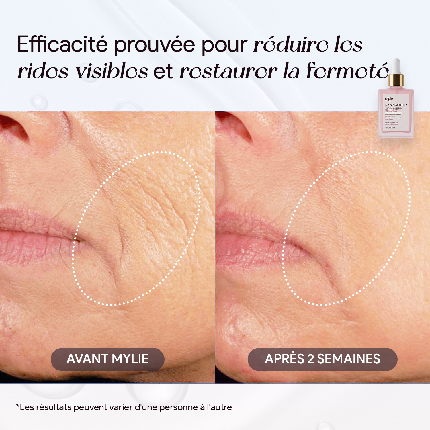 My Facial Plump - Sérum Anti-Âge