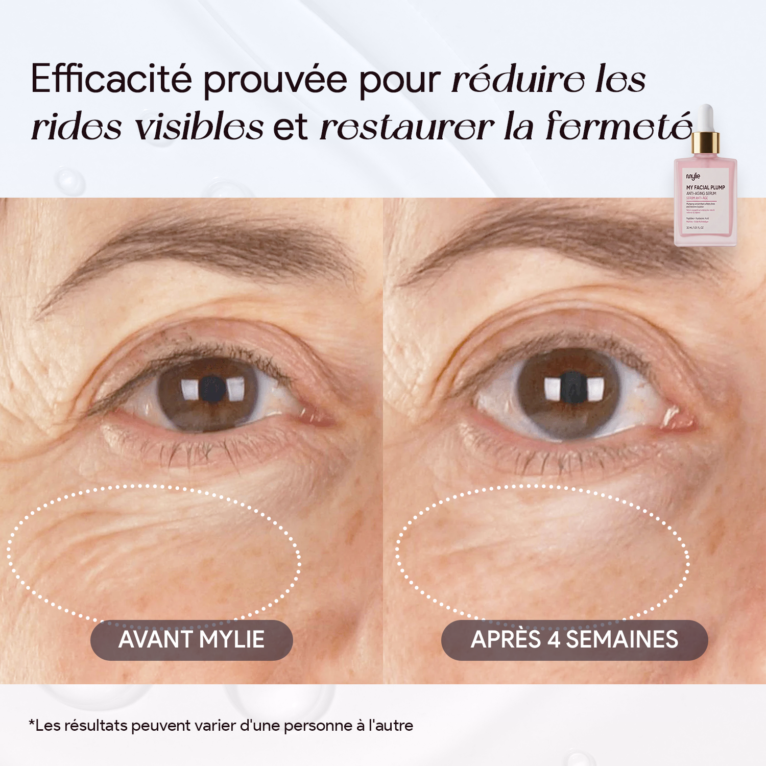 My Facial Plump - Sérum Anti-Âge