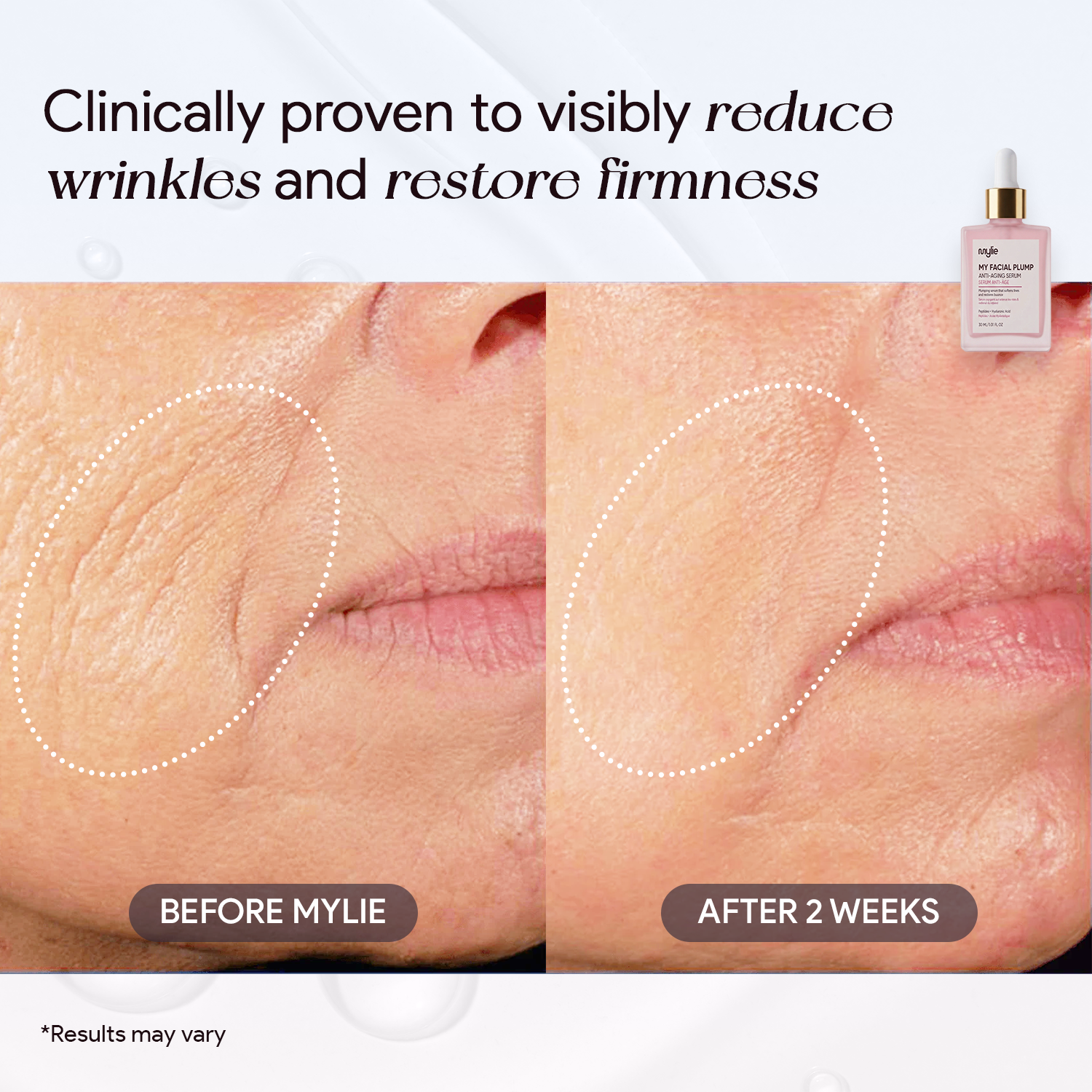 My Facial Plump - Anti-Aging Serum
