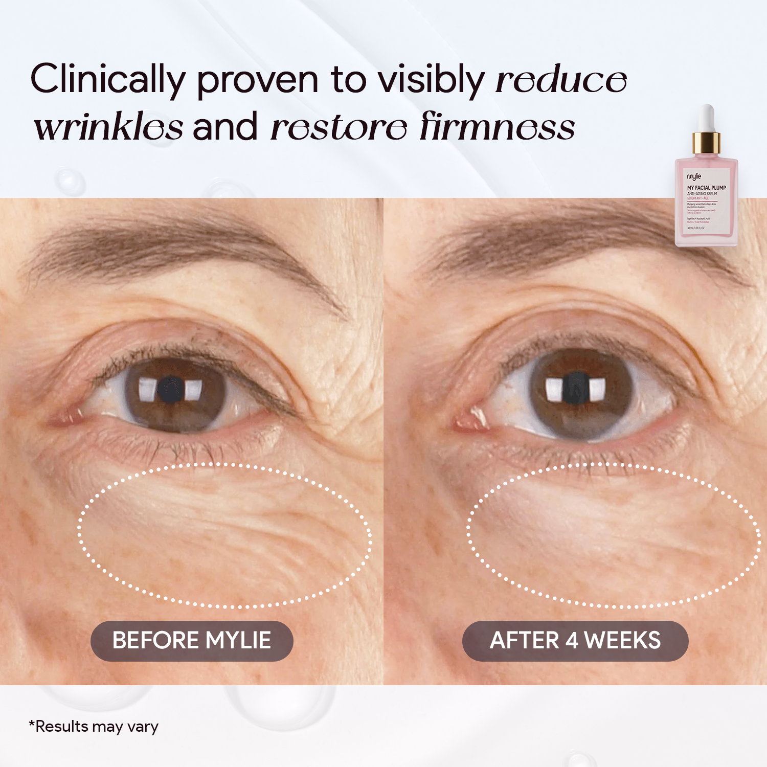 My Facial Plump - Anti-Aging Serum