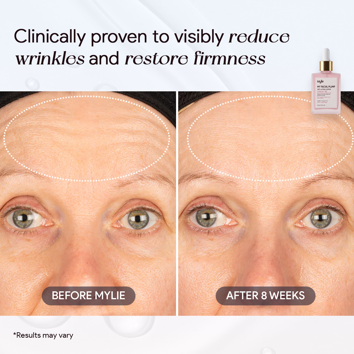 My Facial Plump - Anti-Aging Serum
