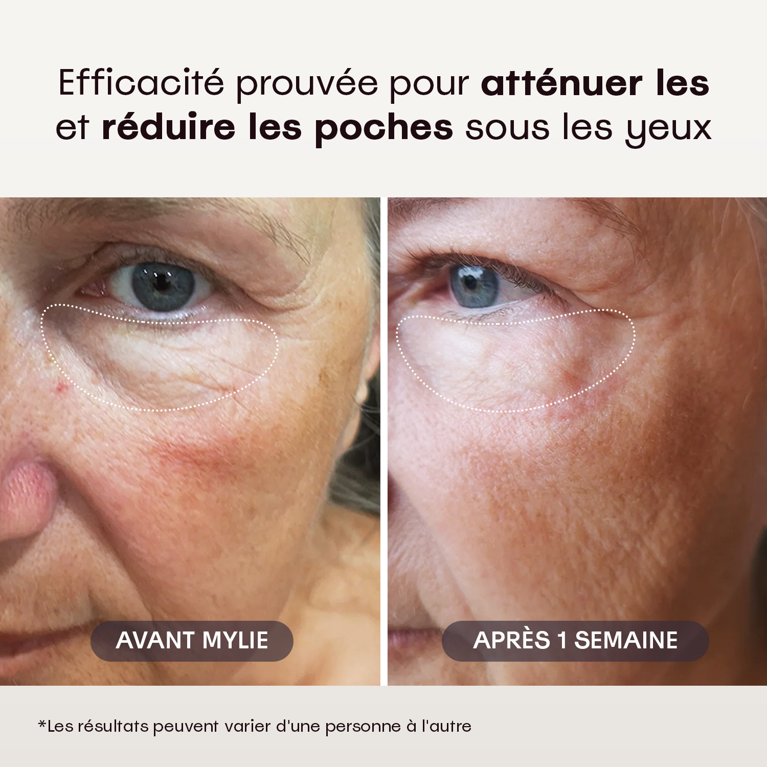 My Eye Restore - Crème Contour des Yeux