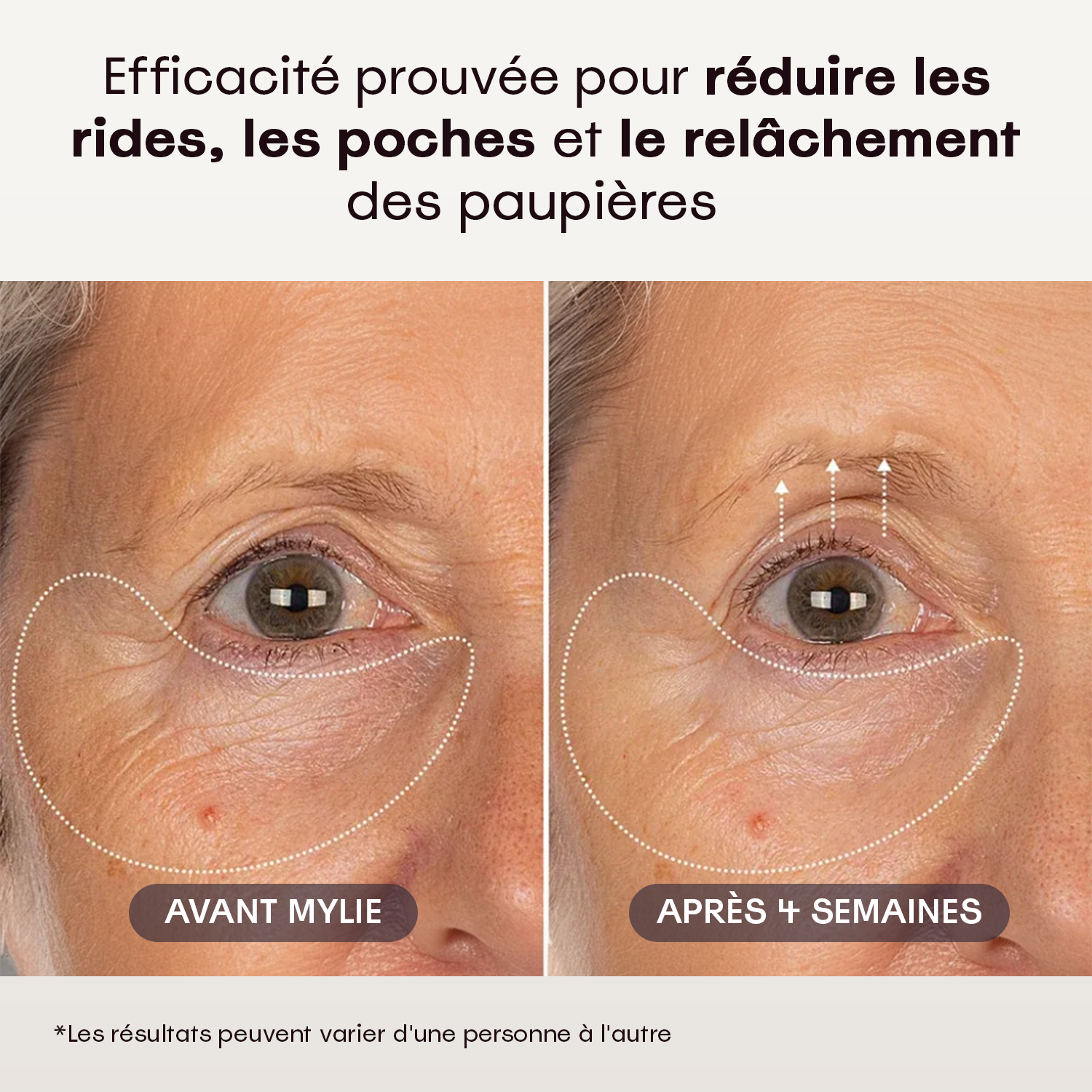 My Eye Restore - Crème Contour des Yeux