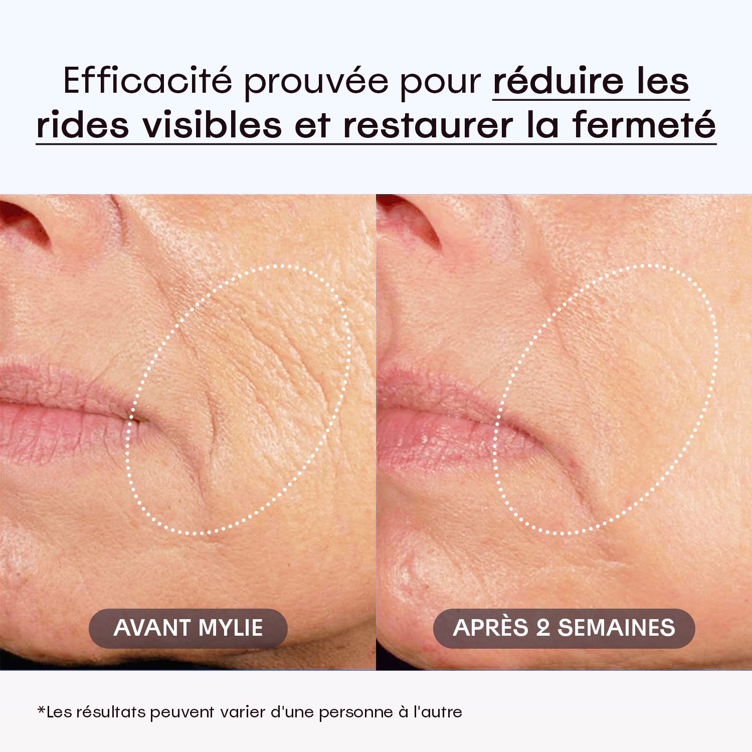 My Facial Plump - Sérum Anti-Âge