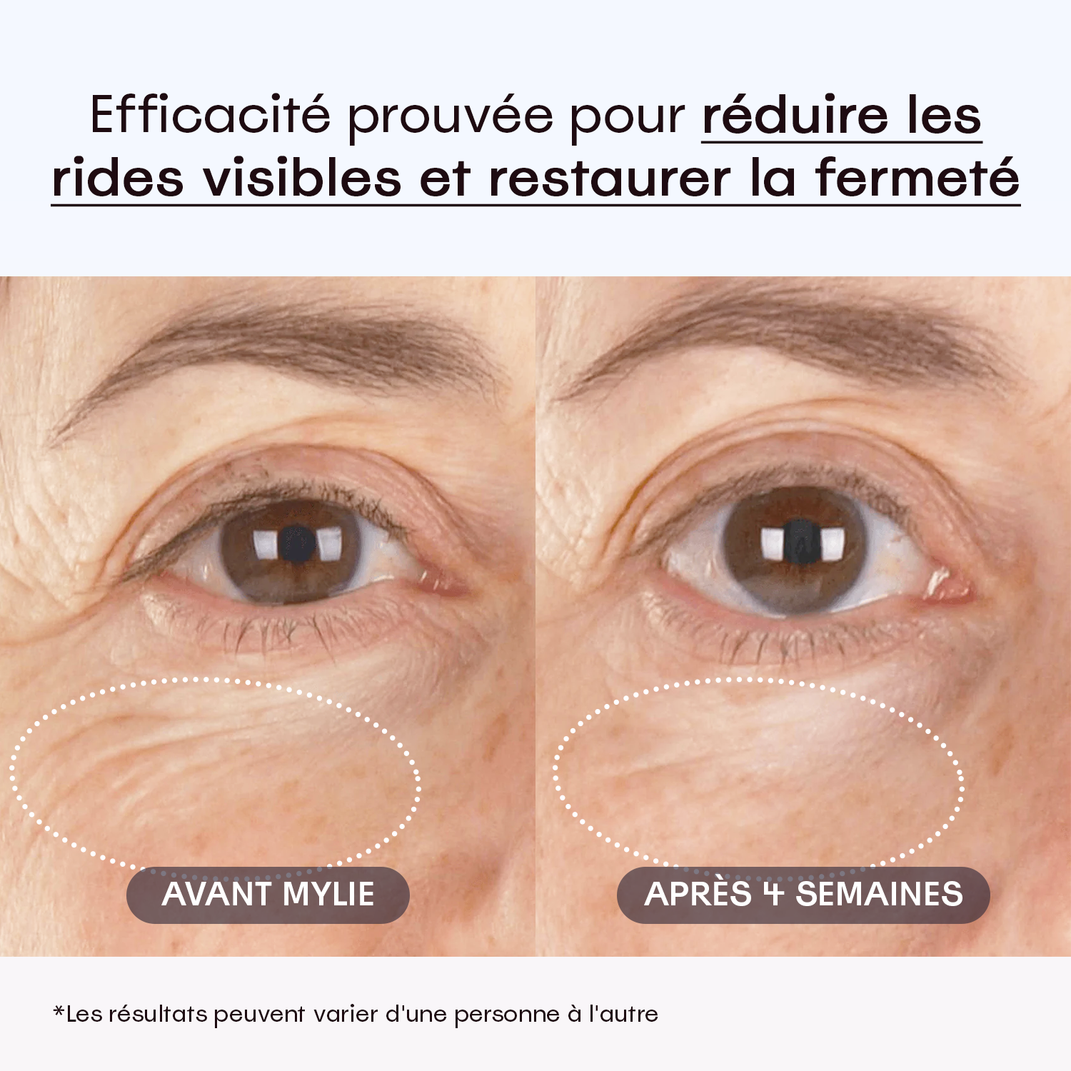 My Facial Plump - Sérum Anti-Âge