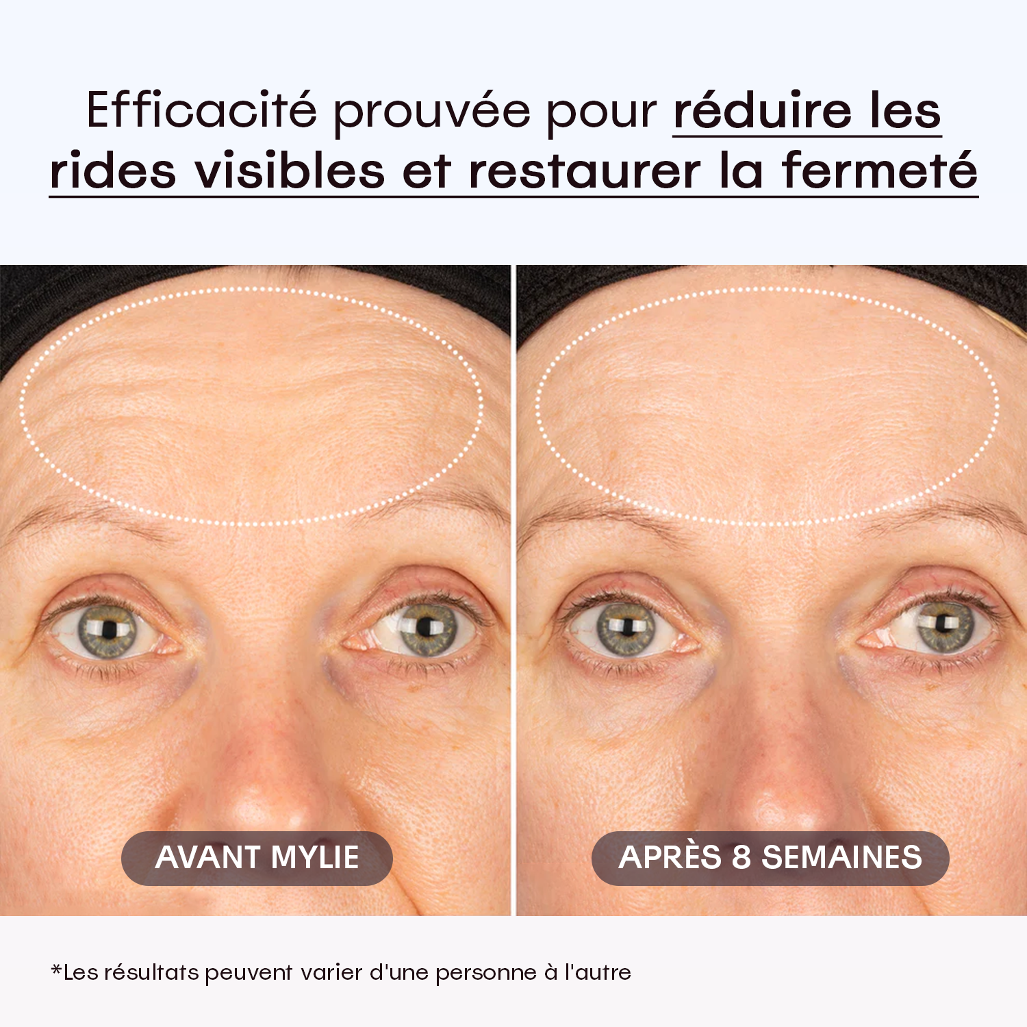 My Facial Plump - Sérum Anti-Âge