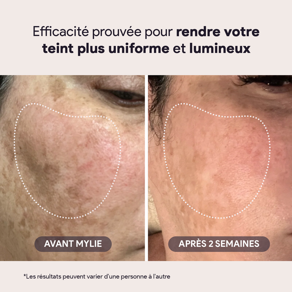 My Repair Serum